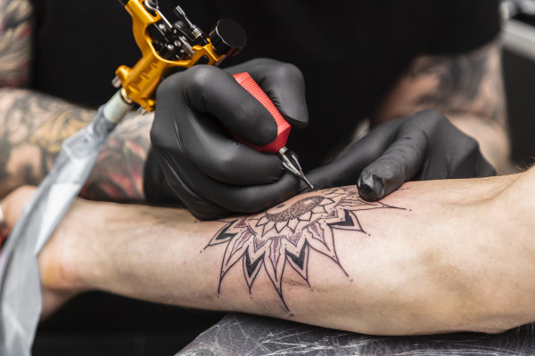 Tattooentfernung Folgebehandlung 5x5cm